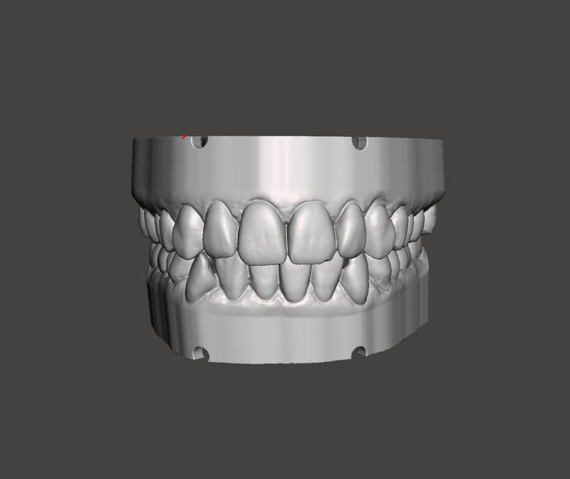 MODELOS DE ESTUDIO DENTAL