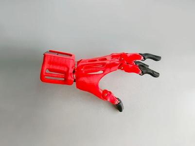 Prosthetic Hand