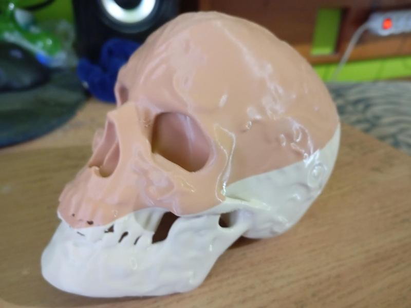 Retarded Skull