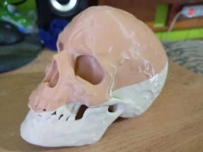 Retarded Skull