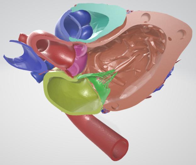 Detachable Parasternal long axis view 3D heart with detailed coronary artery, vein, aortic, pulmonary, mitral and tricuspid valves