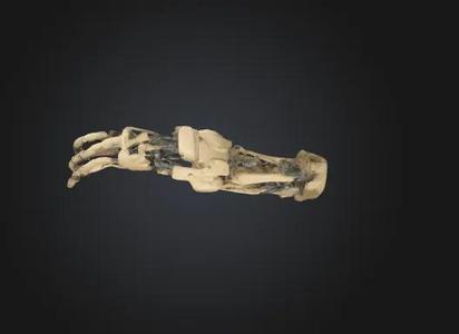 Arm   