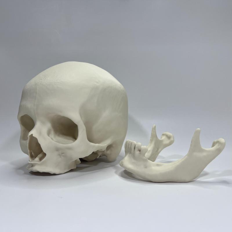 Visible Human Female Cranium and Mandible