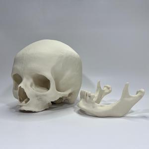 Visible Human Female Cranium and Mandible