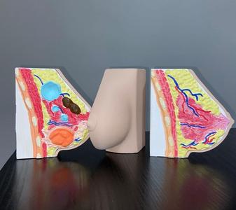 ANATOMIA MAMARIA CON PATOLOGIAS - BREAST ANATOMY WITH PATHOLOGIES