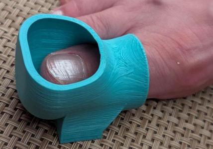 Toe nail treatment cradle