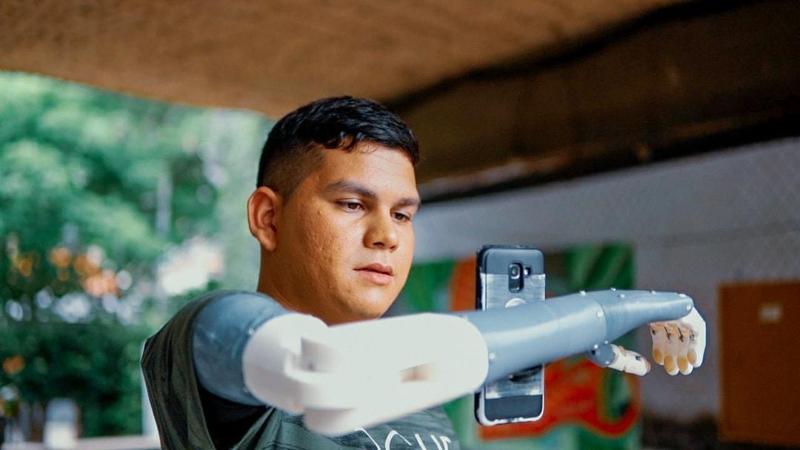 Elpow- Prótesis Transhumeral