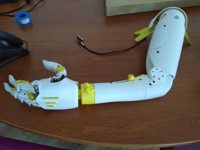 ball joint for prosthetic elbow
