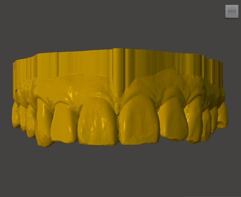 Dental Model
