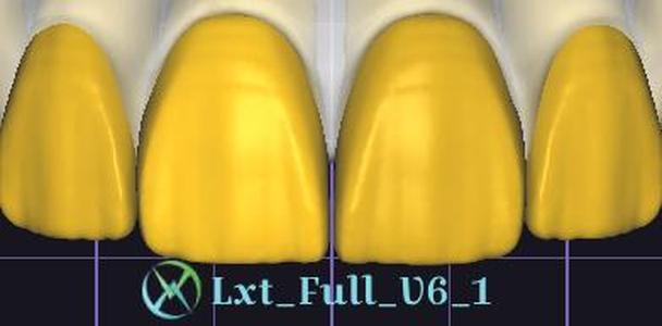 LTX Exocad Library full
