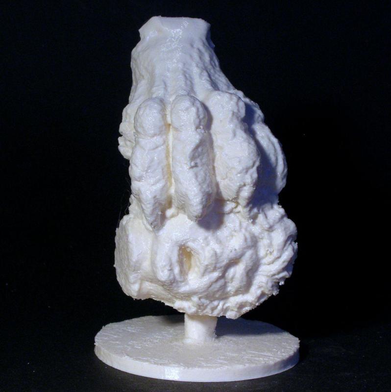 A Severed Head at The Nye Carlsberg Glyptotek, Copenhagen