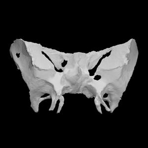 Human sphenoid