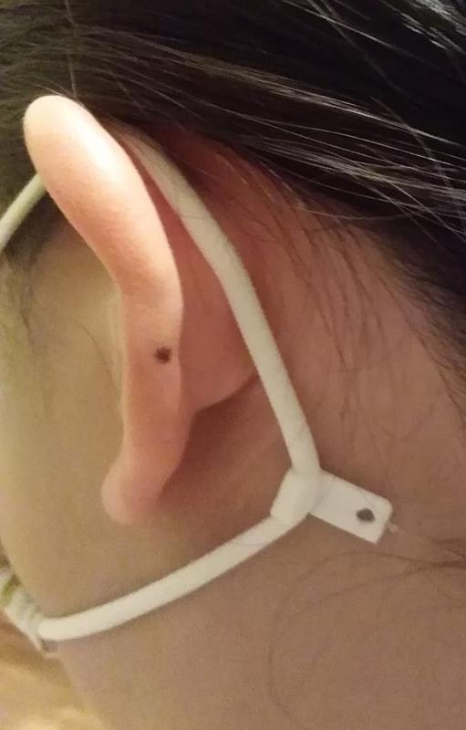 Surgical mask ear pain reduce clip
