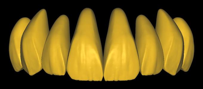 Arabic library for exocad