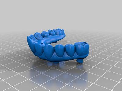 upper and lower full arch implant bridge(all on 4/X) for demo 