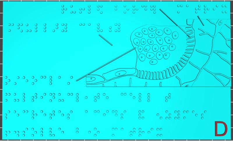 AA Bone Cells - D Osteoclast