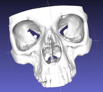 Medical Scans
