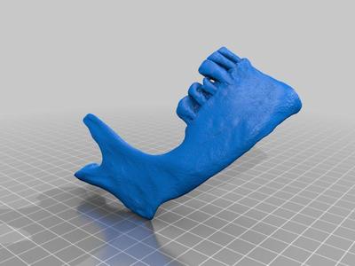Split Human Jaw