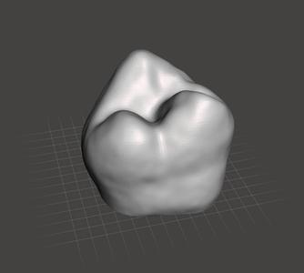 Human Molar Tooth