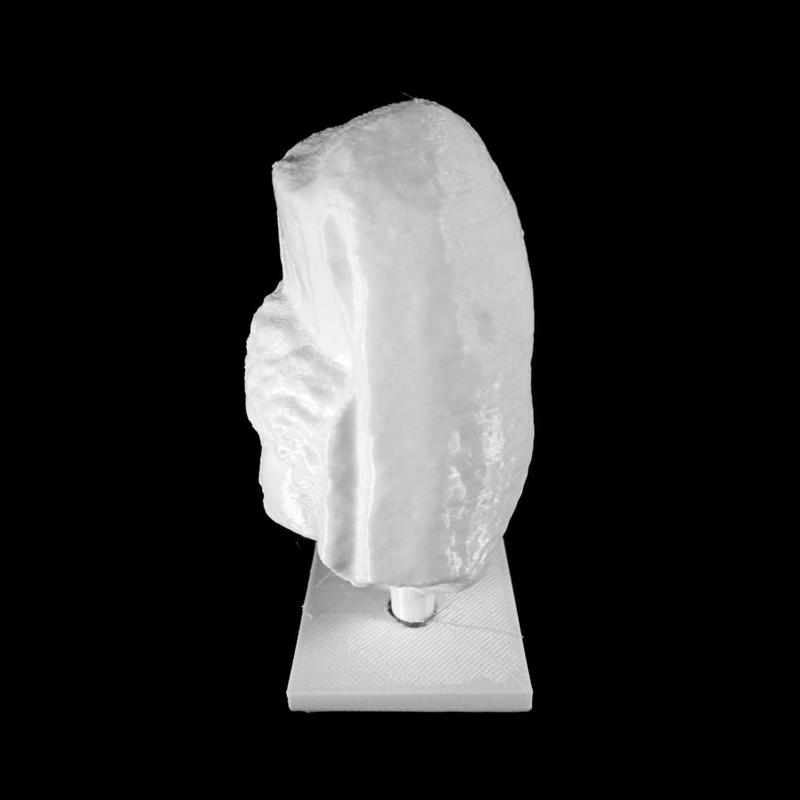 Tyche at The Musée des Beaux-Arts, Lyon