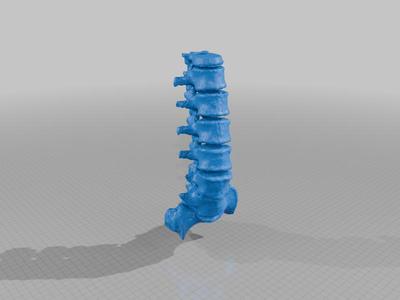Lumbar spine model (with congential defects)