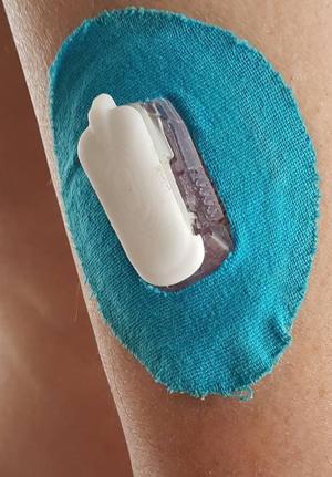 Dexcom G5 Transmitter battery cover