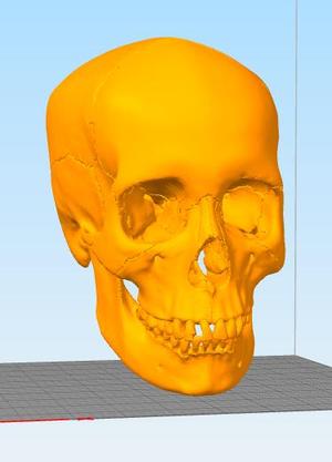 Skull