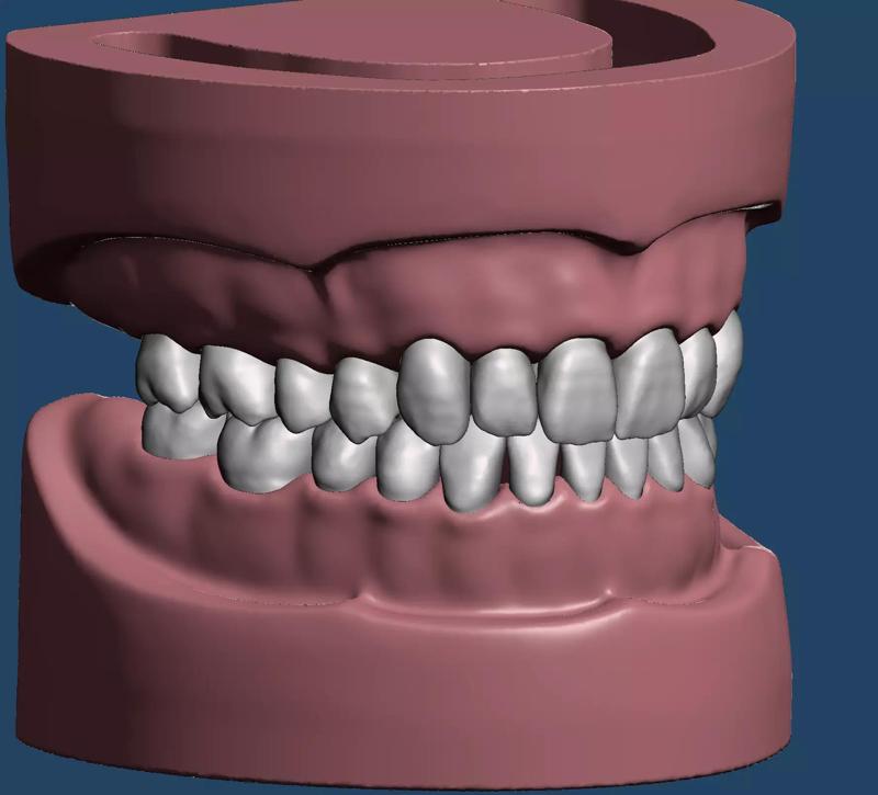 Dental Sample model