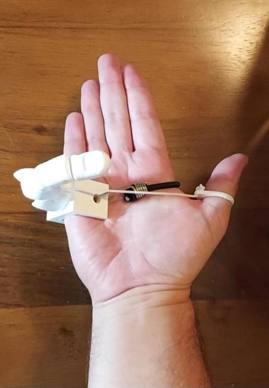 "Pinky Partner" Controllable Prosthetic 6th Finger