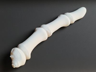 Skeletal Finger – Fragmented Bone Phalanges