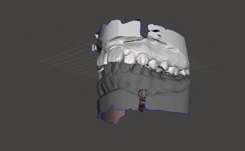 Orthodontics dental model 2