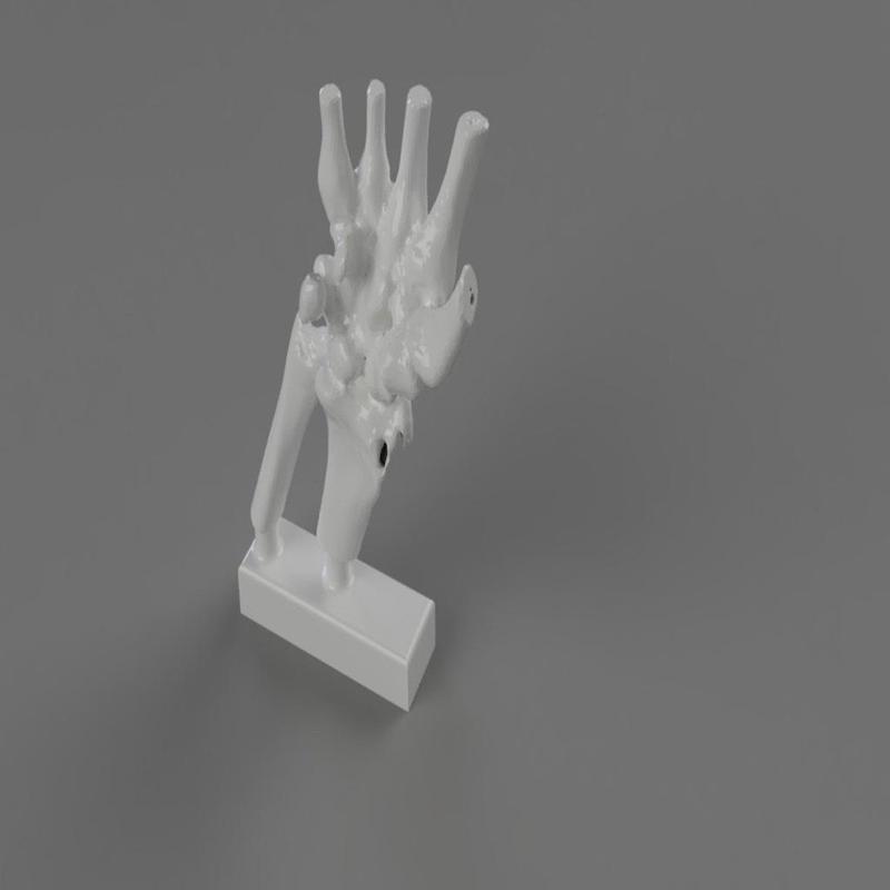 Human Wrist CT scan