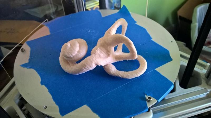 Human Inner Ear (Fixed)