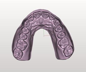 Hybrid Maxillary antagonist