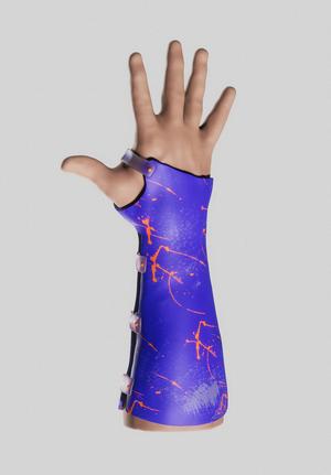 Forearm Splint | Orthosis