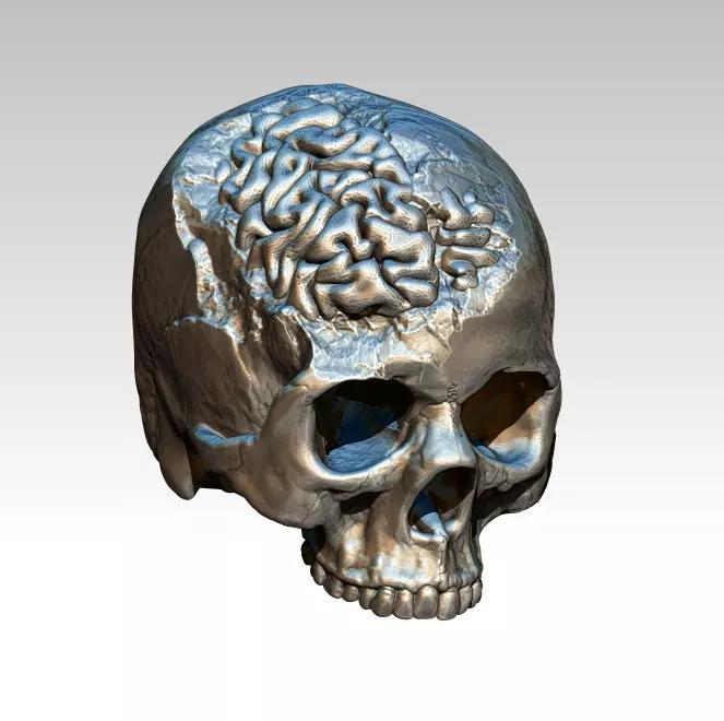 Human Brain Skull Damage Salvage Highpoly Detailed Realistic