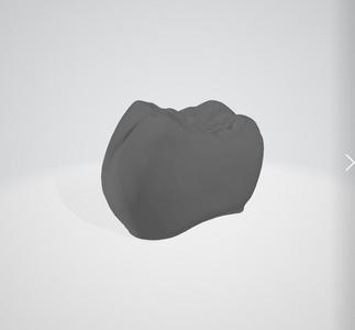 Lower Dental Abutment with Matching Crown - 3D Printable Model