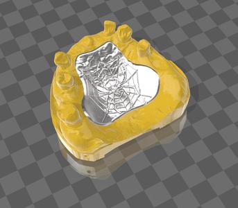 Files for Exocad, stippledpatterns, stamp, Dateien für genarbtes Gusswachs, Stempel, Modellguss, partial