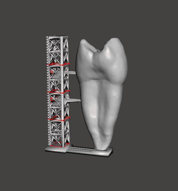 Uper premolar with stand