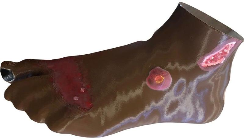 Foot Wound Practice Model