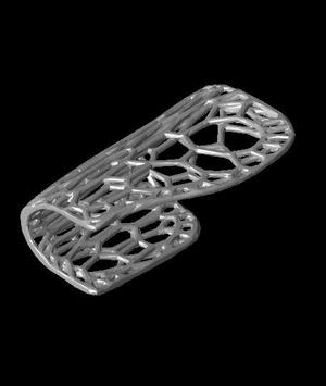 Index_Finger_Splint.stl
