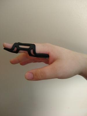 Moldable Finger Splint