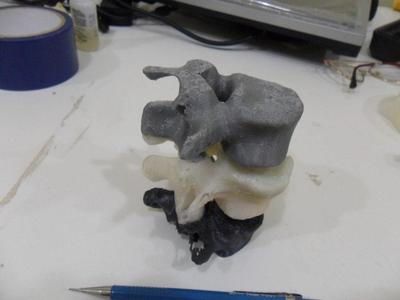 Lombar Vertebra - L3, L4 and L5