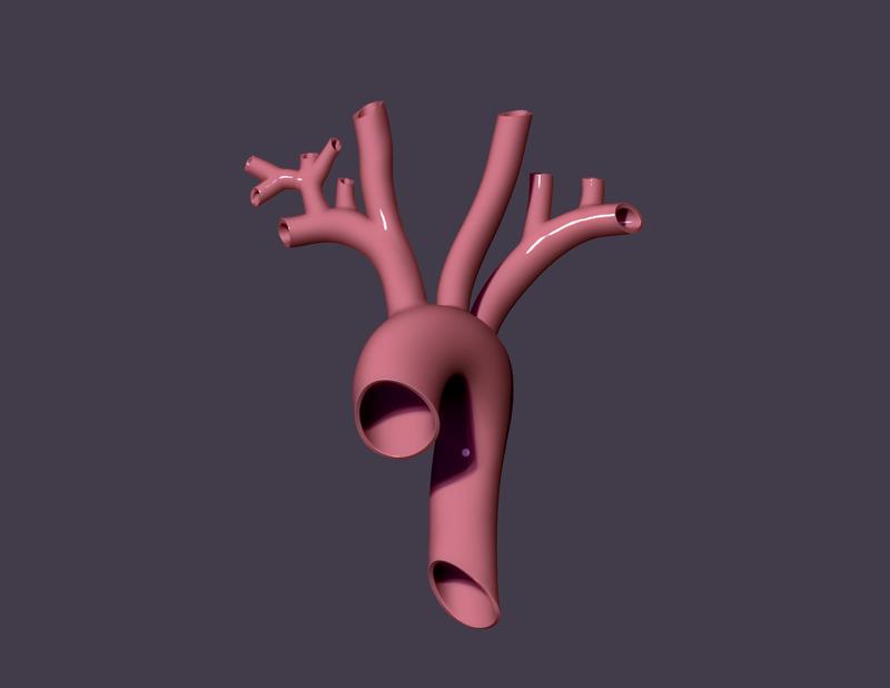 human aorta