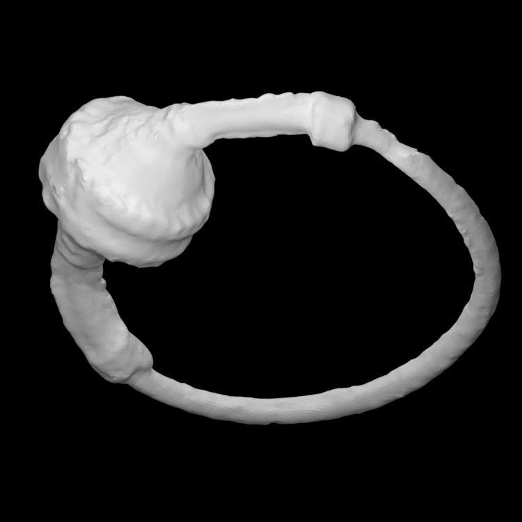 Temporal ring