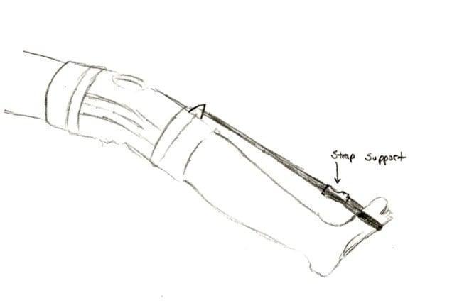 Plantar Fasciitis Pain Reduction Apparatus