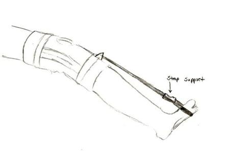 Plantar Fasciitis Pain Reduction Apparatus