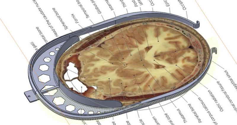 FlipShield model zero