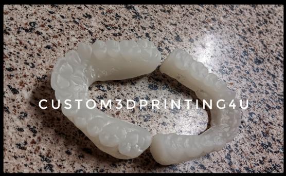 Top and Bottom Teeth Profile Dental Scan