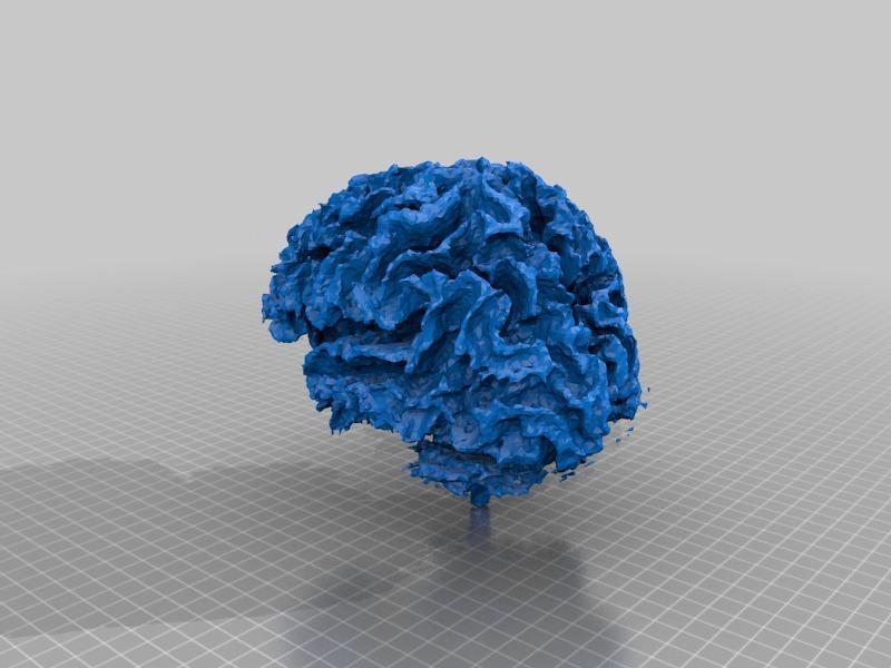 Certified Insane Person's Brain, ---Mine.